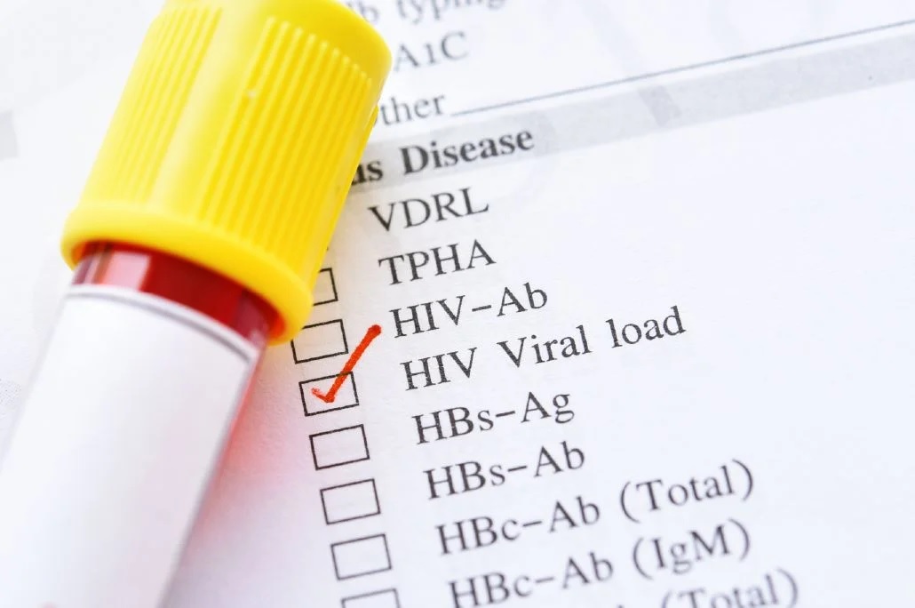 Faltantes de Insumos para Control del VIH: Alerta en Hospitales por Escasez de Reactivos en Argentina