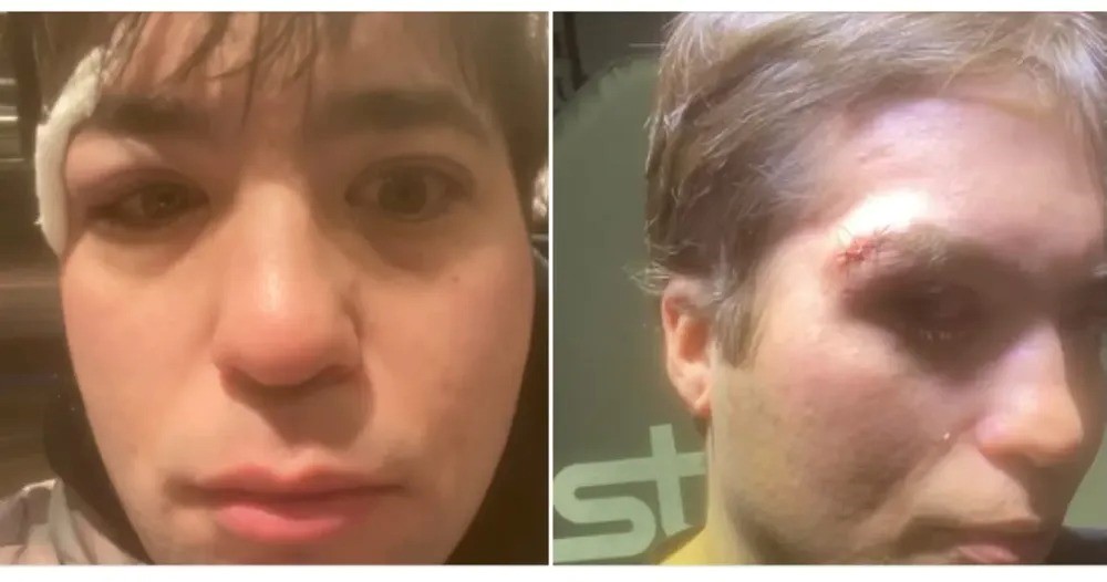 Brutal Agresión a Conductor de Uber en Río Grande: «Me Podrían Haber Matado»