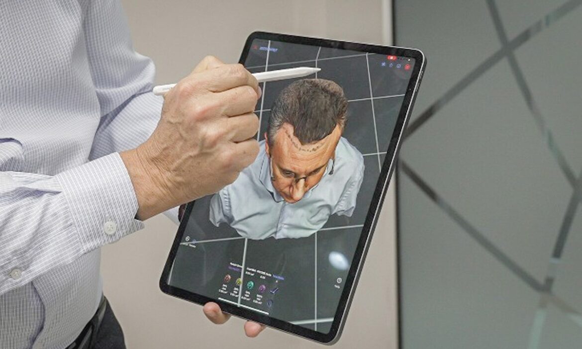 La Inteligencia Artificial Transforma el Diagnóstico y Tratamiento Capilar