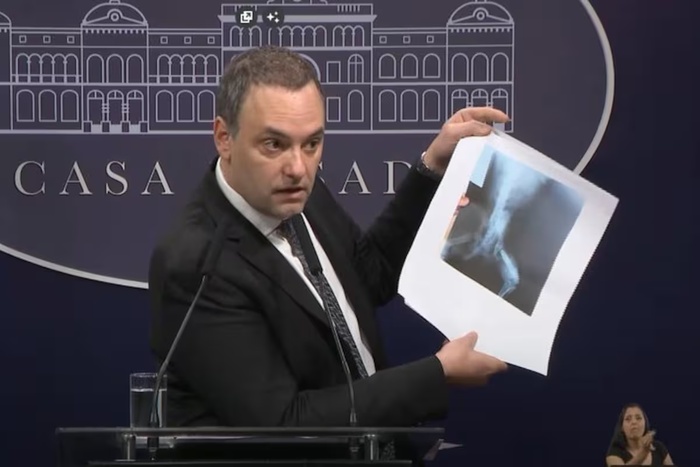 Manuel Adorni: El doble discurso de un difusor de noticias falsas